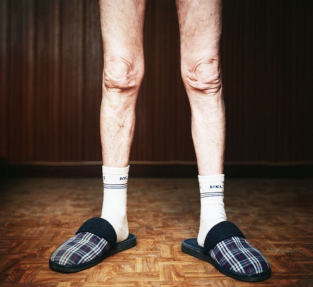 old-man-legs.jpg